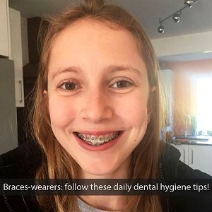 Daily Dental Hygiene Tips for Braces Wearers