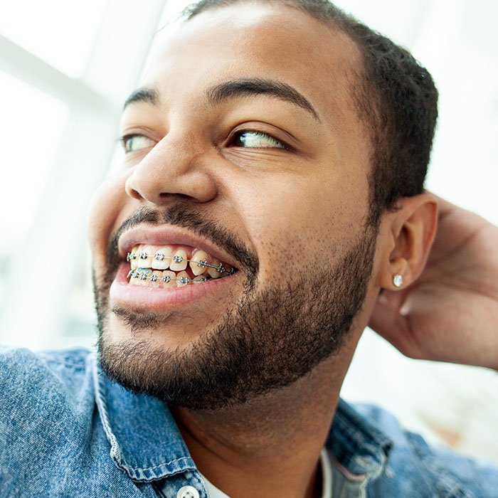 Getting Straight Teeth Has No Age Limit